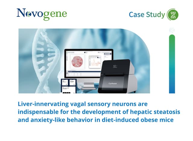 Liver-innervating vagal sensory neurons are indispensable for the development of hepatic steatosis and anxiety-like behavior in diet-induced obese mice